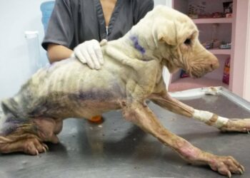 Scarred by a Painful Past—He Fought Through It All to Find His Happy Ending